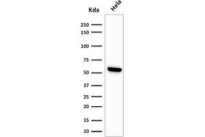 Western Blot Analysis of HeLa cell lysate using HSP60 Monoclonal Antibody (LK1) (HSPD1 抗体)