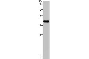 Gel: 10 % SDS-PAGE, Lysate: 40 μg, Lane: Human hepatocellular carcinoma tissue, Primary antibody: (NPHS2 Antibody) at dilution 1/200, Secondary antibody: Goat anti rabbit IgG at 1/8000 dilution, Exposure time: 2 minutes (Podocin 抗体)