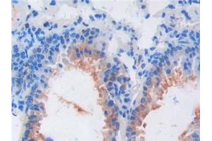 Detection of FGF6 in Mouse Lung Tissue using Polyclonal Antibody to Fibroblast Growth Factor 6 (FGF6) (FGF6 抗体  (AA 39-208))