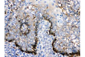 ZAP70 was detected in paraffin-embedded sections of human tonsil tissues using rabbit anti- ZAP70 Antigen Affinity purified polyclonal antibody (Catalog # ) at 1 µg/mL.