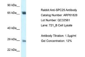 Western Blotting (WB) image for anti-SPC25, NDC80 Kinetochore Complex Component, Homolog (SPC25) (Middle Region) antibody (ABIN2788919) (SPC25 抗体  (Middle Region))