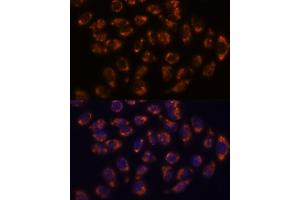 Immunofluorescence analysis of HeLa cells using CRELD1 antibody (ABIN7266621) at dilution of 1:100. (CRELD1 抗体  (AA 50-150))