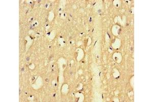 Immunohistochemistry of paraffin-embedded human brain tissue using ABIN7171786 at dilution of 1:100 (FAM46C 抗体  (AA 1-391))