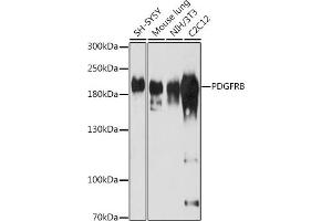Western Blotting (WB) image for anti-Platelet Derived Growth Factor Receptor beta (PDGFRB) (AA 887-1106) antibody (ABIN3023139)