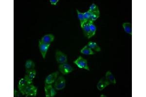 Immunofluorescence staining of Hela cells with ABIN7127774 at 1:36, counter-stained with DAPI. (Recombinant PRKAR1A 抗体)