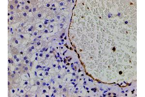 Immunohistochemistry (IHC) image for anti-Cofilin 1 (CFL1) (pSer3) antibody (ABIN6255180)
