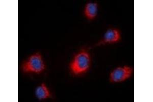 Immunofluorescent analysis of MID1 staining in HeLa cells. (MID1 抗体  (N-Term))