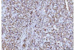 IHC analysis of CD147/Emmprin using anti-CD147/Emmprin antibody (ABIN7599997). (CD147 抗体  (AA 138-323))