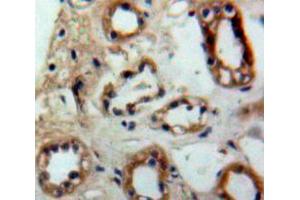 Used in DAB staining on fromalin fixed paraffin-embedded Kidney tissue (PTGES2 抗体  (AA 145-357))