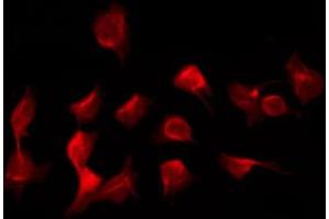 ABIN6266963 staining K562 by IF/ICC. (Epsin 1 抗体)
