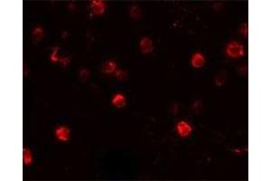 Immunofluorescencent staining of Daudi cells with CD244 polyclonal antibody  at 20 ug/mL. (2B4 抗体  (C-Term))