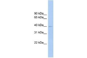 FCRLA antibody used at 1 ug/ml to detect target protein. (FCRLA 抗体  (Middle Region))