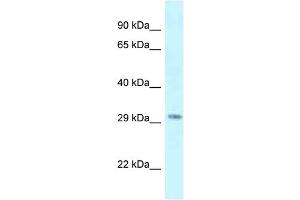 Antibody Titration: 1. (SUV420H1 抗体  (C-Term))
