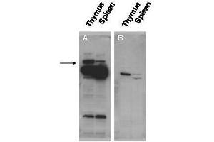 Western blot using  affinity purified anti-Pogz antibody shows detection of Pogz protein (arrowhead) in adult mouse thymus and spleen tissue lysate (Panel A). (POGZ 抗体  (N-Term))