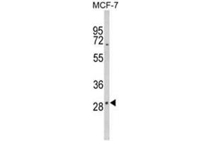 Western blot analysis of DIO2 Antibody (Center) in MCF-7 cell line lysates (35ug/lane). (DIO2 抗体  (Middle Region))