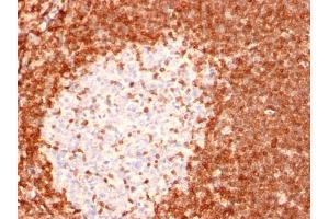 Immunohistochemistry (IHC) image for anti-B-Cell CLL/lymphoma 2 (BCL2) (AA 41-54) antibody (ABIN6940494)