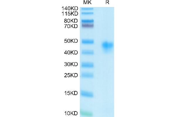 CD25 Protein (AA 22-213) (His-Avi Tag)