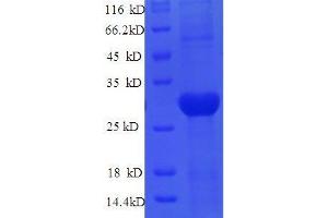 SDS-PAGE (SDS) image for Lysyl Oxidase (LOX) (AA 163-411) protein (His tag) (ABIN7584987)