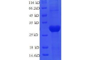Lysyl Oxidase (LOX) (AA 163-411) protein (His tag) expressed in E. (LOX Protein (AA 163-411) (His tag))