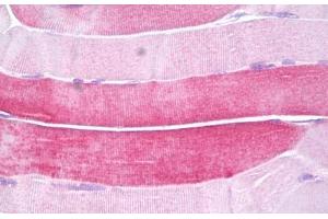 Anti-HSPB6 antibody IHC staining of human skeletal muscle. (HSPB6 抗体  (AA 5-54))