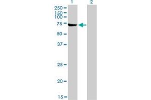 Western Blot analysis of ABCF2 expression in transfected 293T cell line by ABCF2 monoclonal antibody (M01), clone 1D11.