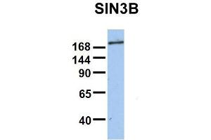 Host:  Rabbit  Target Name:  SIN3B  Sample Type:  Human Fetal Brain  Antibody Dilution:  1.