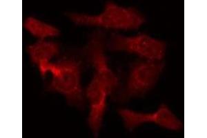 ABIN6275469 staining Hela by IF/ICC. (RAB40B 抗体  (C-Term))