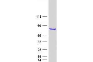Western Blotting (WB) image for RNA Binding Motif Protein 46 (RBM46) protein (Myc-DYKDDDDK Tag) (ABIN2730621)