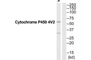 Western Blotting (WB) image for anti-Cytochrome P450, Family 4, Subfamily V, Polypeptide 2 (CYP4V2) (Internal Region) antibody (ABIN1852634) (CYP4V2 抗体  (Internal Region))