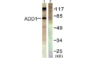 Western blot analysis of extracts from Hela cells treated with Forskolin (40nM, 30min), using ADD1 (Ab-726) antibody (#B0002, Line 1 and 2). (alpha Adducin 抗体  (Ser726))
