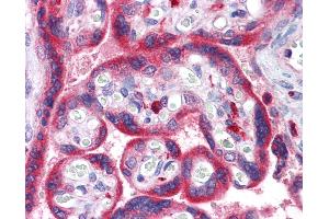 Anti-ADAM15 antibody IHC of human placenta. (ADAM15 抗体  (AA 1-225))