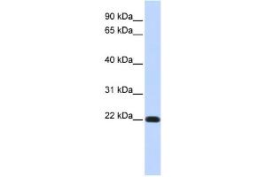 WB Suggested Anti-FXYD5 Antibody Titration:  0. (FXYD5 抗体  (Middle Region))