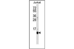 Western blot analysis of POLR2G Antibody (C-term) in Jurkat cell line lysates (35ug/lane). (POLR2G 抗体  (C-Term))