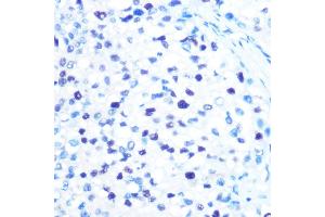 Immunohistochemistry (IHC) image for anti-Minichromosome Maintenance Complex Component 3 (MCM3) antibody (ABIN7268540)