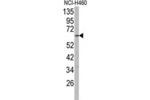 Western Blotting (WB) image for anti-Cytochrome P450, Family 2, Subfamily R, Polypeptide 1 (CYP2R1) antibody (ABIN3003558) (CYP2R1 抗体)