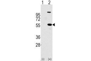 Western blot analysis of ALDH1A1 antibody and 293 cell lysate (2 ug/lane) either nontransfected (Lane 1) or transiently transfected with the ALDH1A1 gene (2). (ALDH1A1 抗体  (AA 302-331))