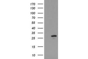 Image no. 1 for anti-Ubiquitin-Conjugating Enzyme E2S (UBE2S) antibody (ABIN1501646) (UBE2S 抗体)