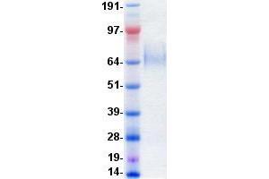 Western Blotting (WB) image for Neurotrophic Tyrosine Kinase, Receptor, Type 1 (NTRK1) protein (DYKDDDDK-His Tag) (ABIN2734329)