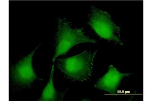 Immunofluorescence of monoclonal antibody to RIOK2 on HeLa cell. (RIOK2 抗体  (AA 453-551))