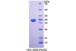 SDS-PAGE analysis of Mouse HABP1 Protein. (C1QBP 蛋白)
