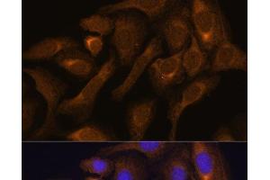 Immunofluorescence analysis of U-2 OS cells using SHMT1 Polyclonal Antibody at dilution of 1:100. (SHMT1 抗体)