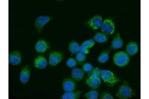 IF analysis of Glutaminase/GLS using anti-Glutaminase/GLS antibody (ABIN7601601).