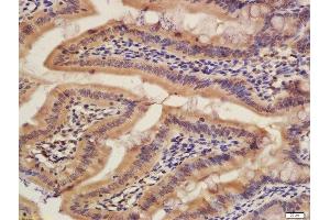 Formalin-fixed and paraffin embedded rat colon labeled with Rabbit Rabbit Anti-CISD1 Polyclonal Antibody, Unconjugated (ABIN2173059) at 1:200 followed by conjugation to the secondary antibody and DAB staining (CISD1 抗体  (AA 51-108))