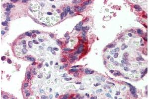 Placenta, Human: Formalin-Fixed, Paraffin-Embedded (FFPE) (GPSM2 抗体  (AA 72-121))