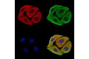 ABIN7094499 and ABIN7098548 staining Hela cells by IF/ICC. (SAA2 抗体  (Internal Region))