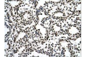 Image no. 1 for anti-Zinc Finger Protein 706 (ZNF706) (N-Term) antibody (ABIN6737704) (ZNF706 抗体  (N-Term))