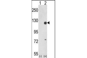 Western blot analysis of PTK2 (arrow) using rabbit polyclonal PTK2 Antibody (Center) (ABIN1882121 and ABIN2842373).