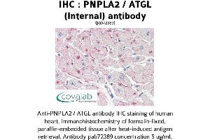 Image no. 1 for anti-Patatin-Like phospholipase Domain Containing 2 (PNPLA2) (Internal Region) antibody (ABIN1738173) (PNPLA2 抗体  (Internal Region))