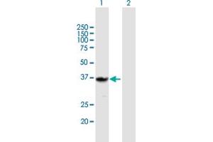 Western Blot analysis of QPRT expression in transfected 293T cell line by QPRT MaxPab polyclonal antibody. (QPRT 抗体  (AA 1-297))