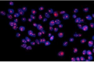 IF analysis of RRS1 using anti-RRS1 antibody (ABIN7601344). (RRS1 抗体  (AA 33-266))